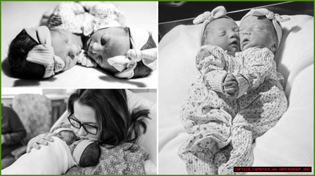 **The Inspiring Journey Of Matthew And Breana Dell: Conjoined Twins**