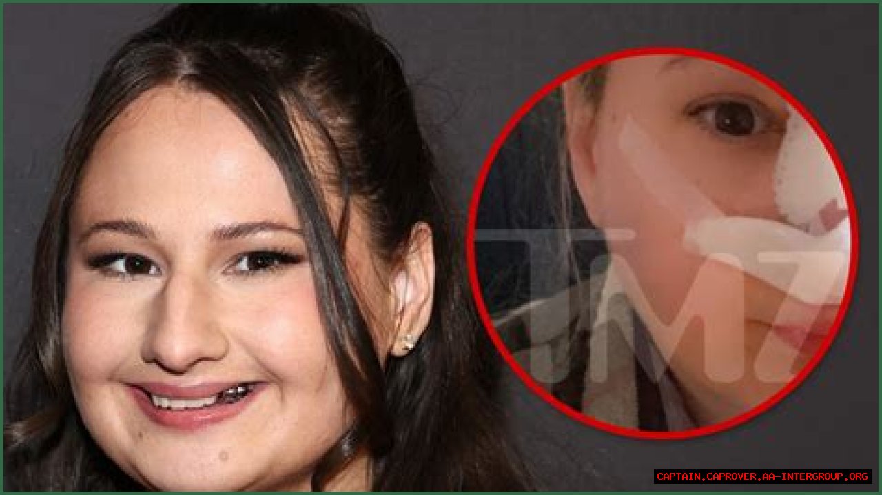 Unveiling The Transformation: The Nose Job Of Gypsy Rose