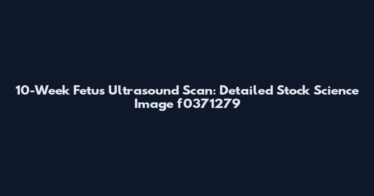10-Week Fetus Ultrasound Scan: Detailed Stock Science Image f0371279