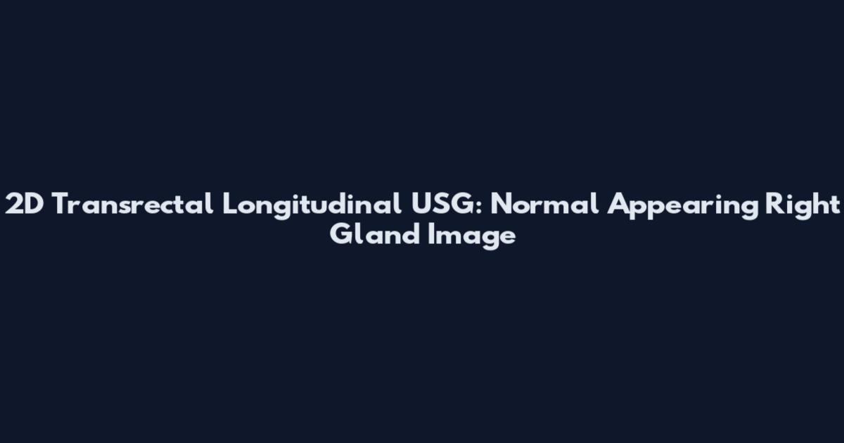 2D Transrectal Longitudinal USG: Normal Appearing Right Gland Image