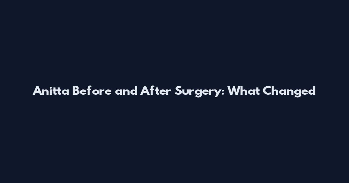 Anitta Before and After Surgery: What Changed