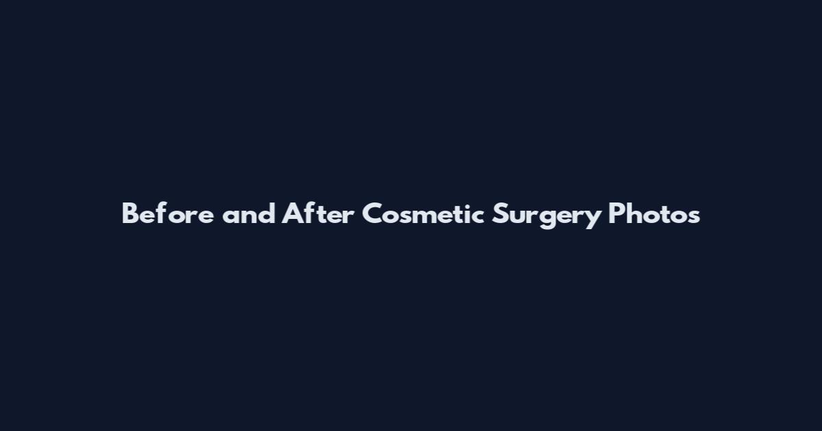 Before and After Cosmetic Surgery Photos