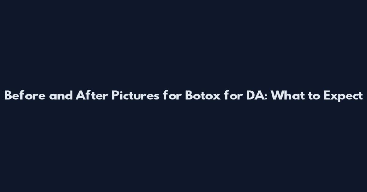 Before and After Pictures for Botox for DA: What to Expect