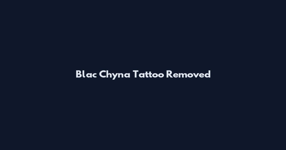 Blac Chyna Tattoo Removed