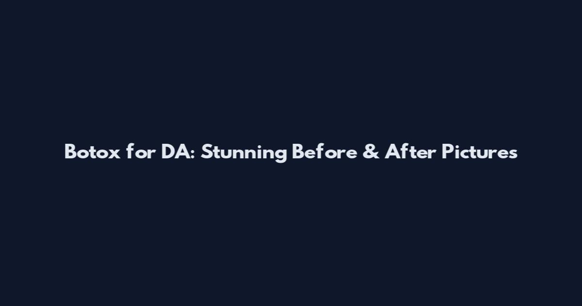 Botox for DA: Stunning Before & After Pictures
