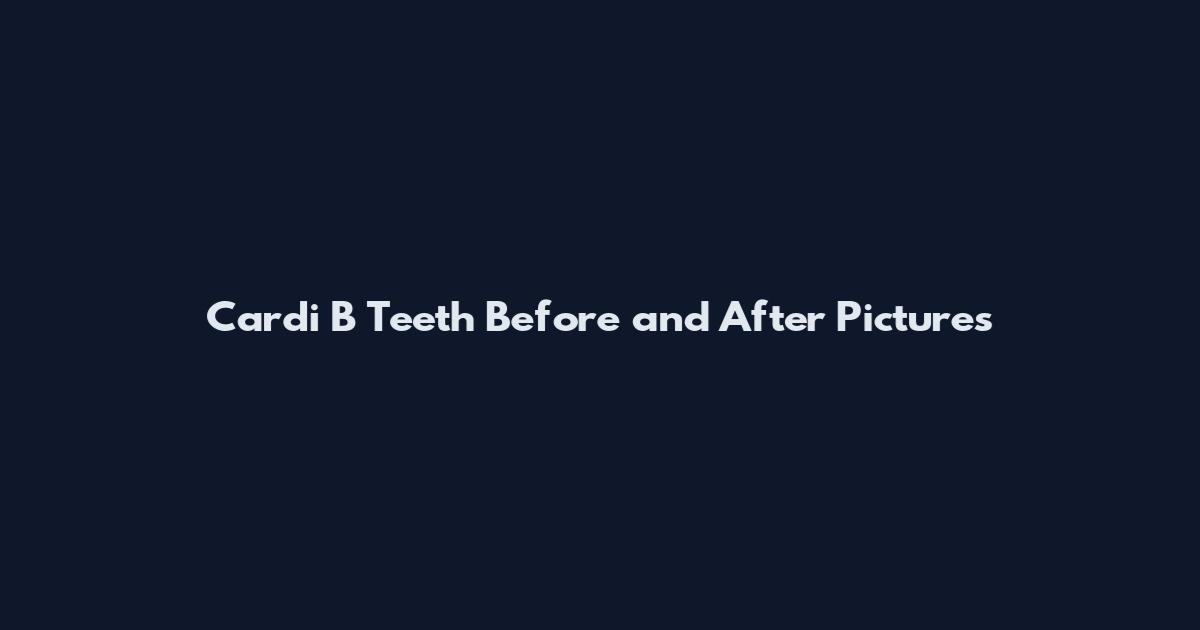 Cardi B Teeth Before and After Pictures
