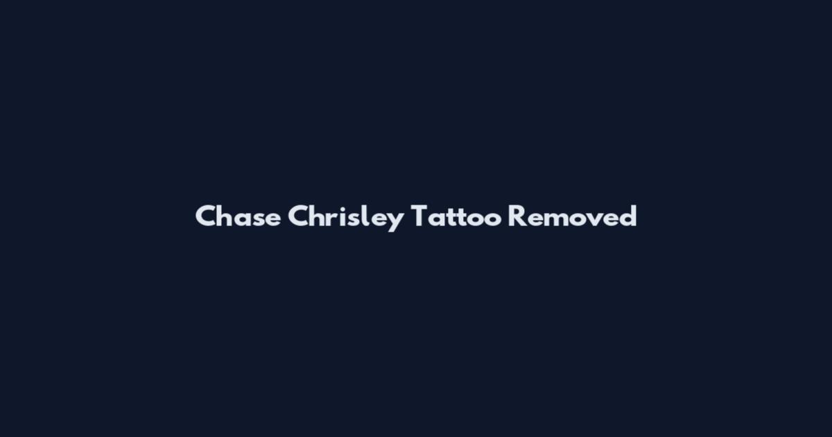 Chase Chrisley Tattoo Removed