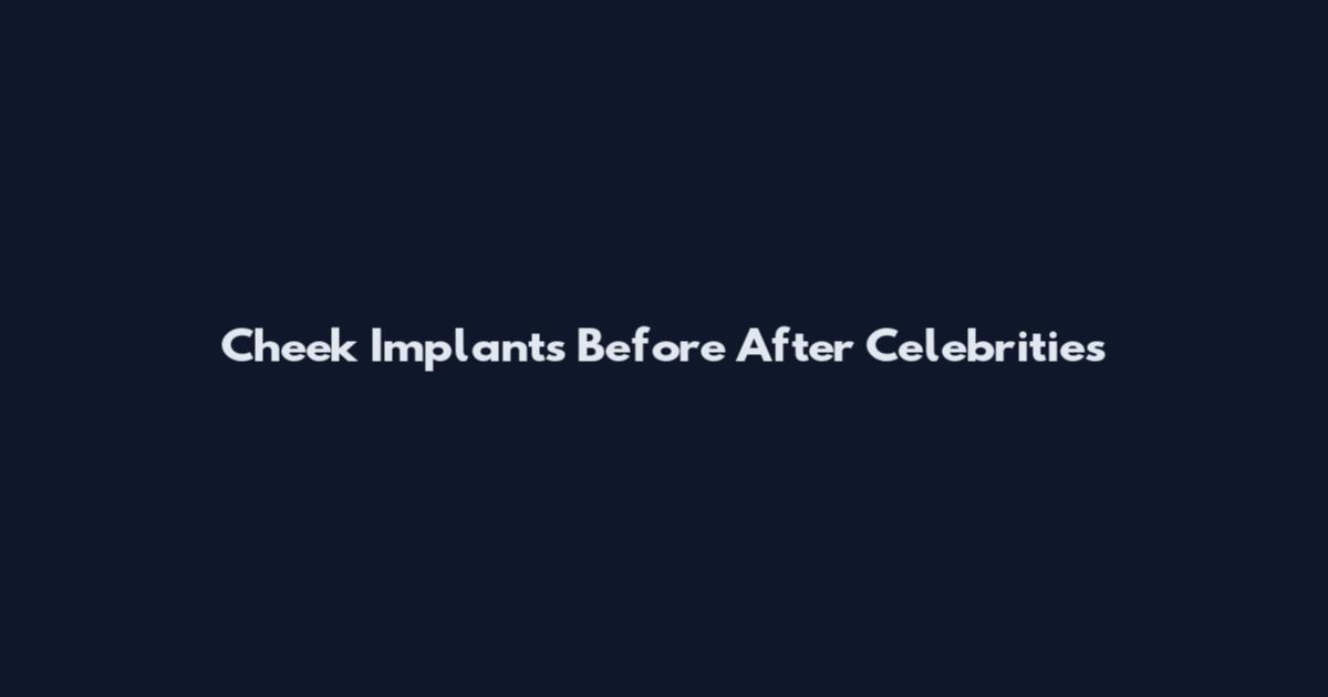Cheek Implants Before After Celebrities