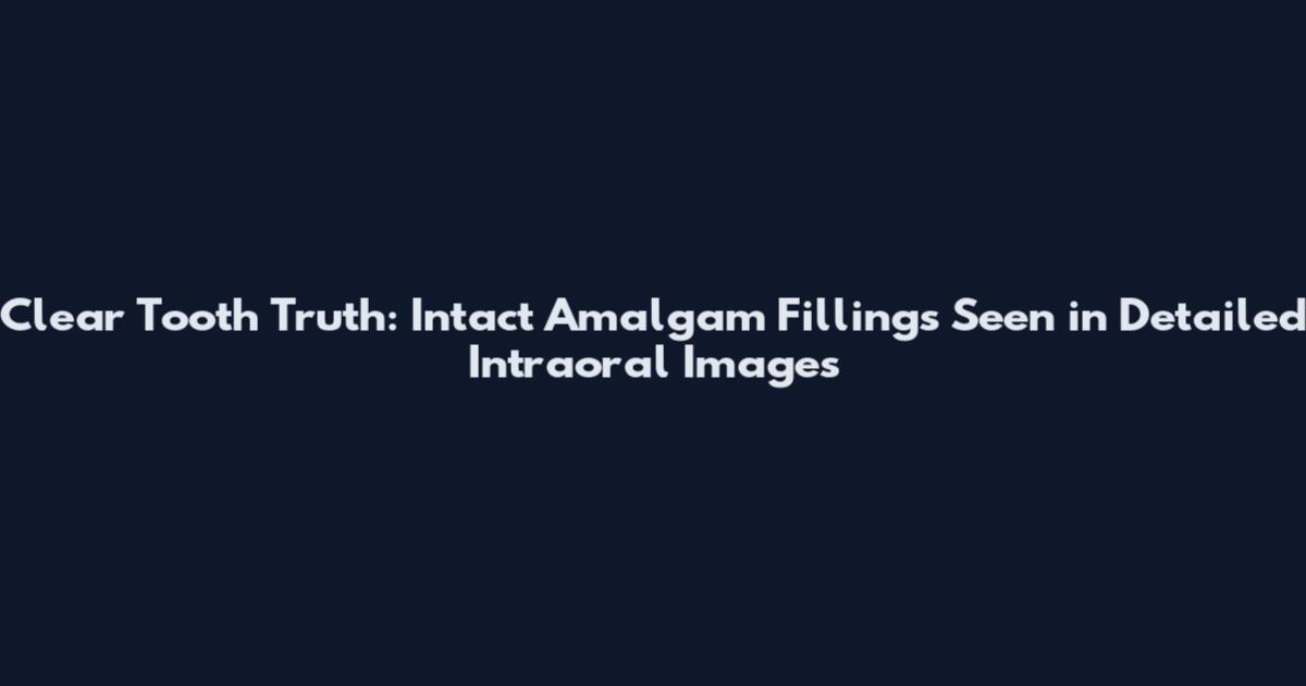 Clear Tooth Truth: Intact Amalgam Fillings Seen in Detailed Intraoral Images
