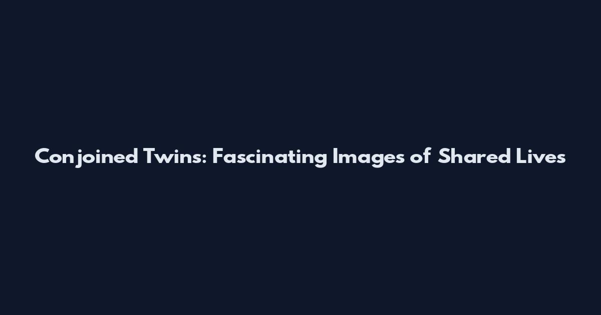 Conjoined Twins: Fascinating Images of Shared Lives