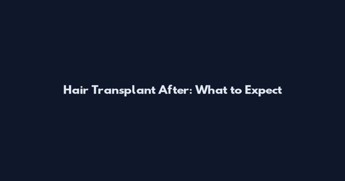 Hair Transplant After: What to Expect
