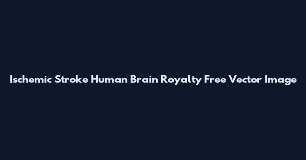 Ischemic Stroke Human Brain Royalty Free Vector Image