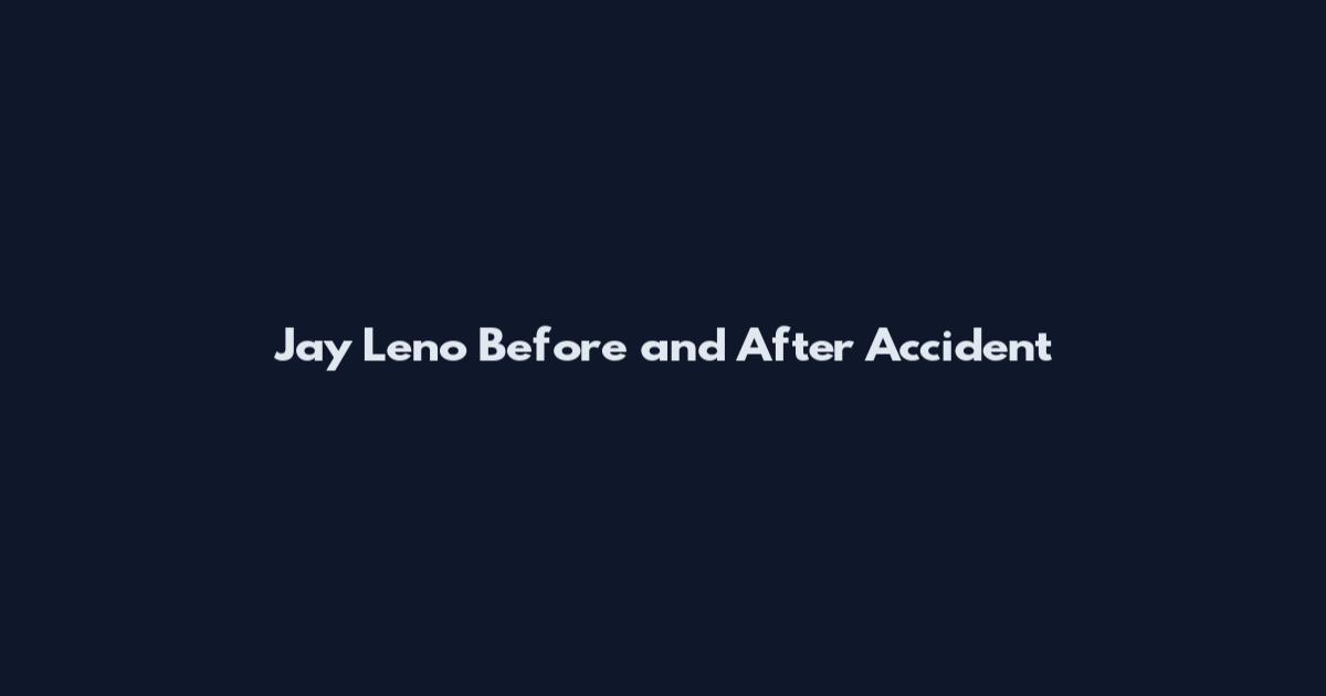 Jay Leno Before and After Accident