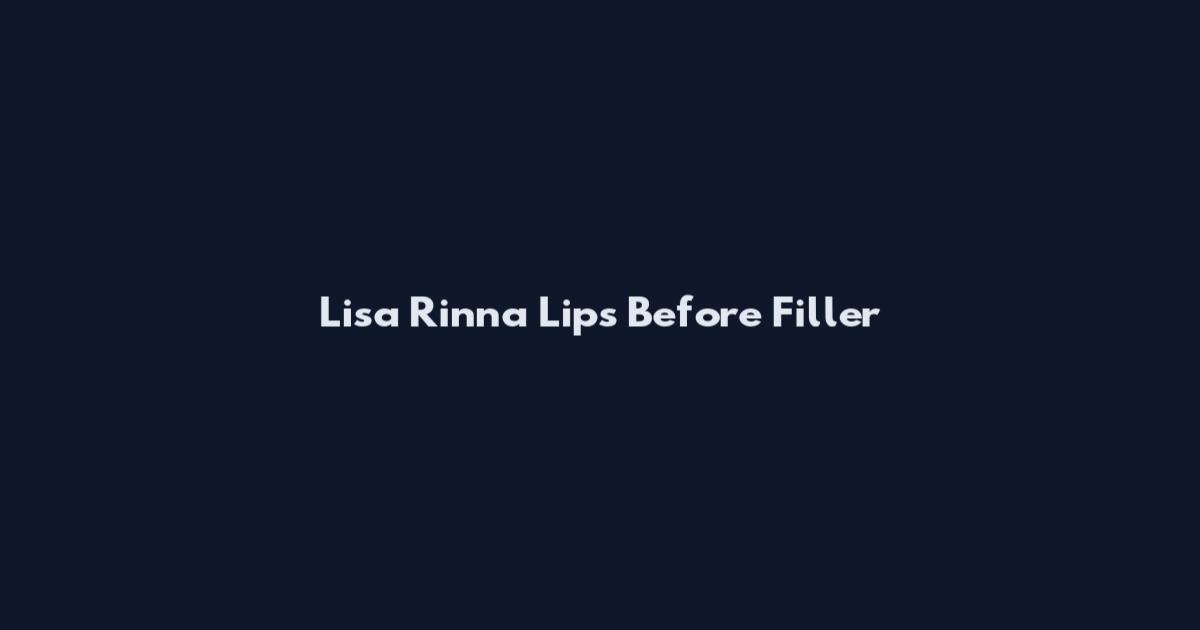 Lisa Rinna Lips Before Filler