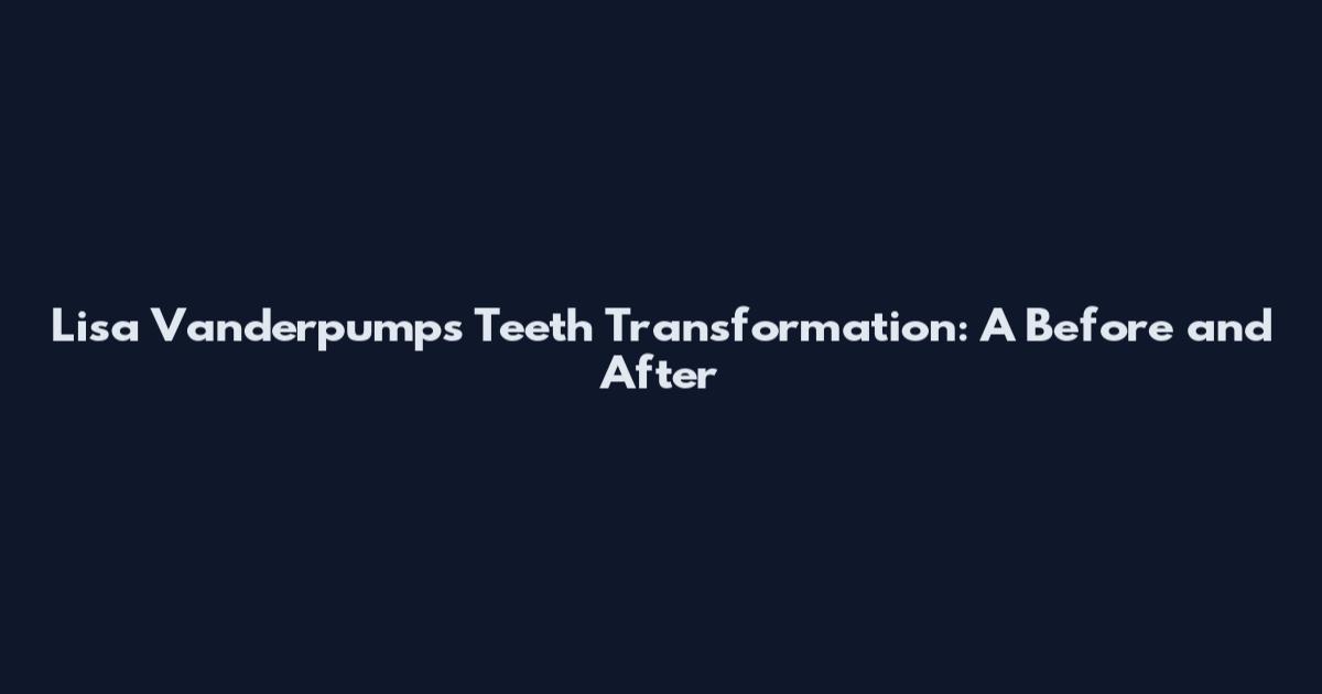 Lisa Vanderpump's Teeth Transformation: A Before and After