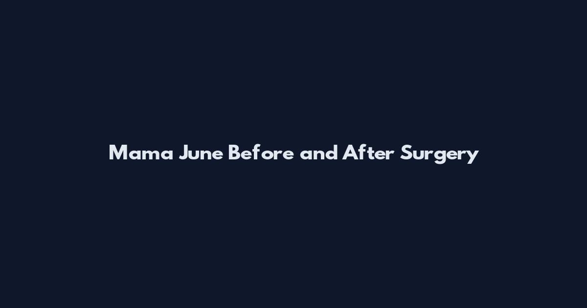 Mama June Before and After Surgery