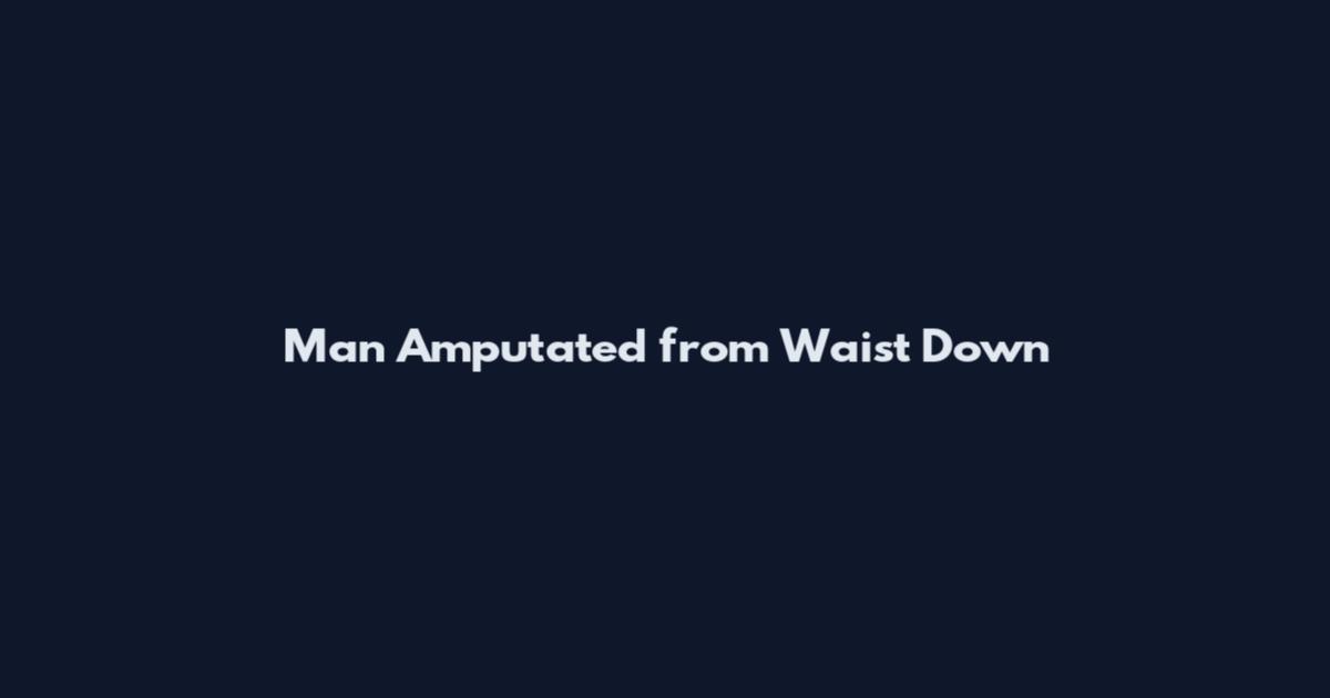 Man Amputated from Waist Down