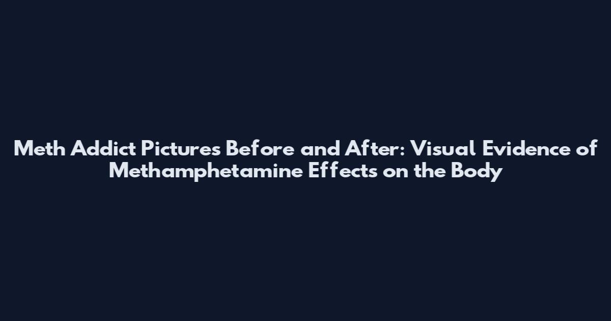 Meth Addict Pictures Before and After: Visual Evidence of Methamphetamine Effects on the Body
