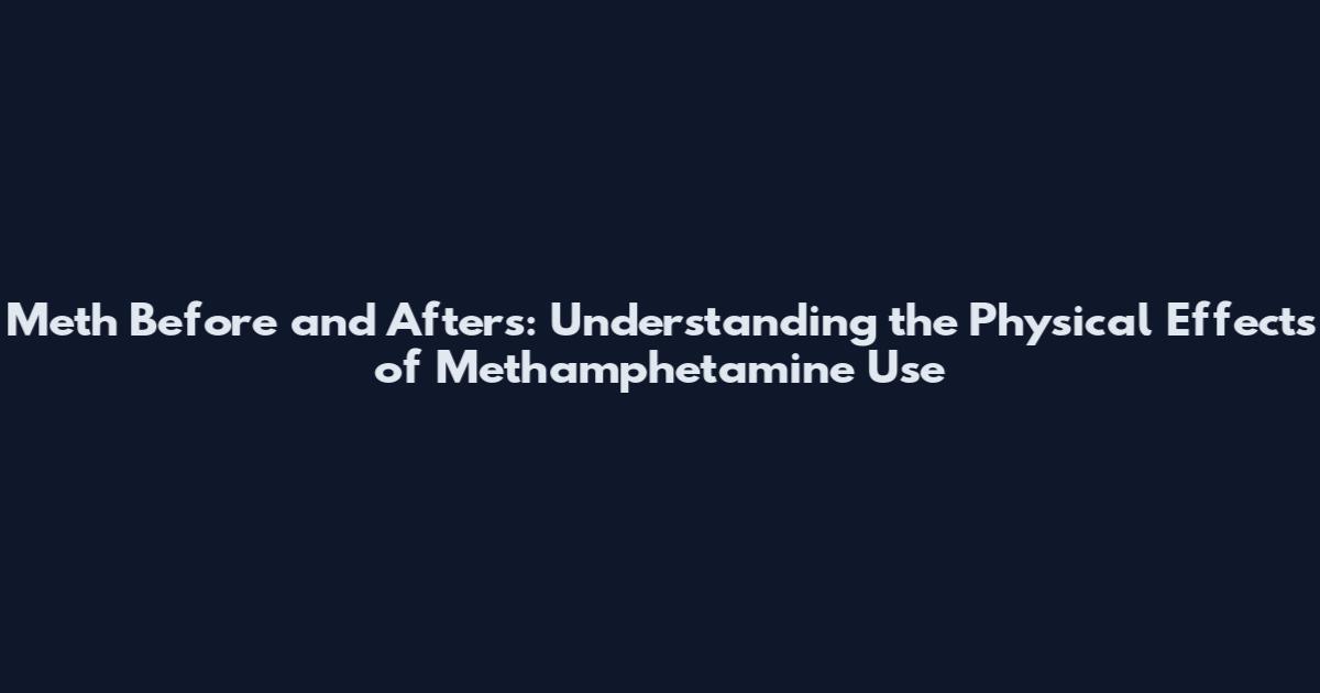 Meth Before and Afters: Understanding the Physical Effects of Methamphetamine Use