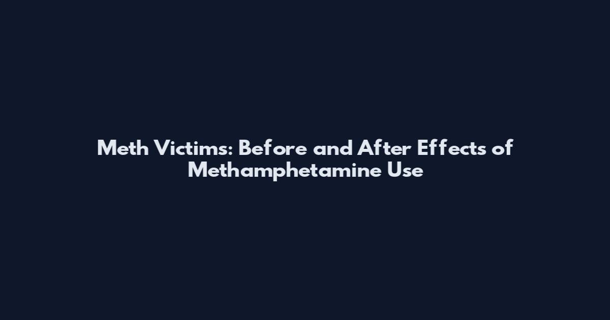 Meth Victims: Before and After Effects of Methamphetamine Use