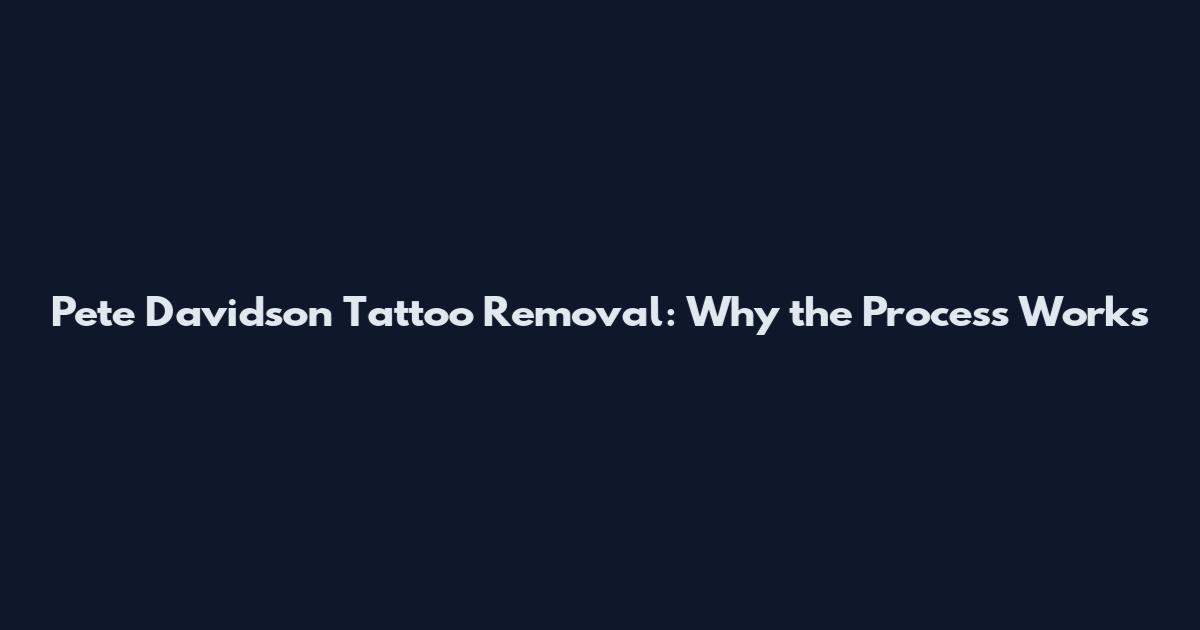 Pete Davidson Tattoo Removal: Why the Process Works