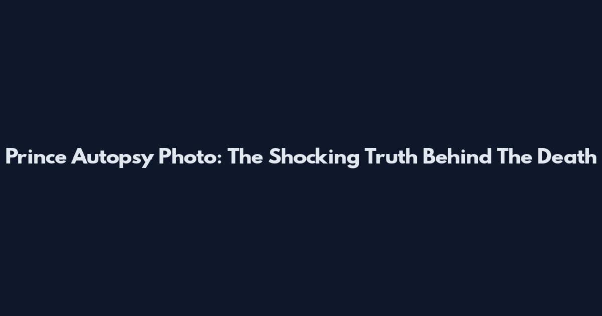 Prince Autopsy Photo: The Shocking Truth Behind The Death