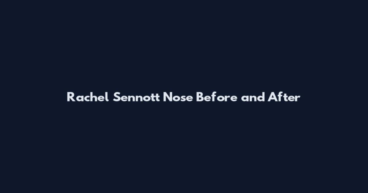 Rachel Sennott Nose Before and After