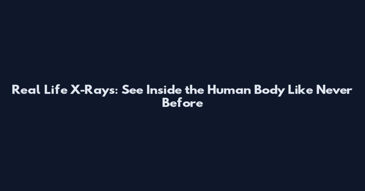 Real Life X-Rays: See Inside the Human Body Like Never Before