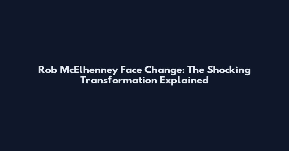Rob McElhenney Face Change: The Shocking Transformation Explained