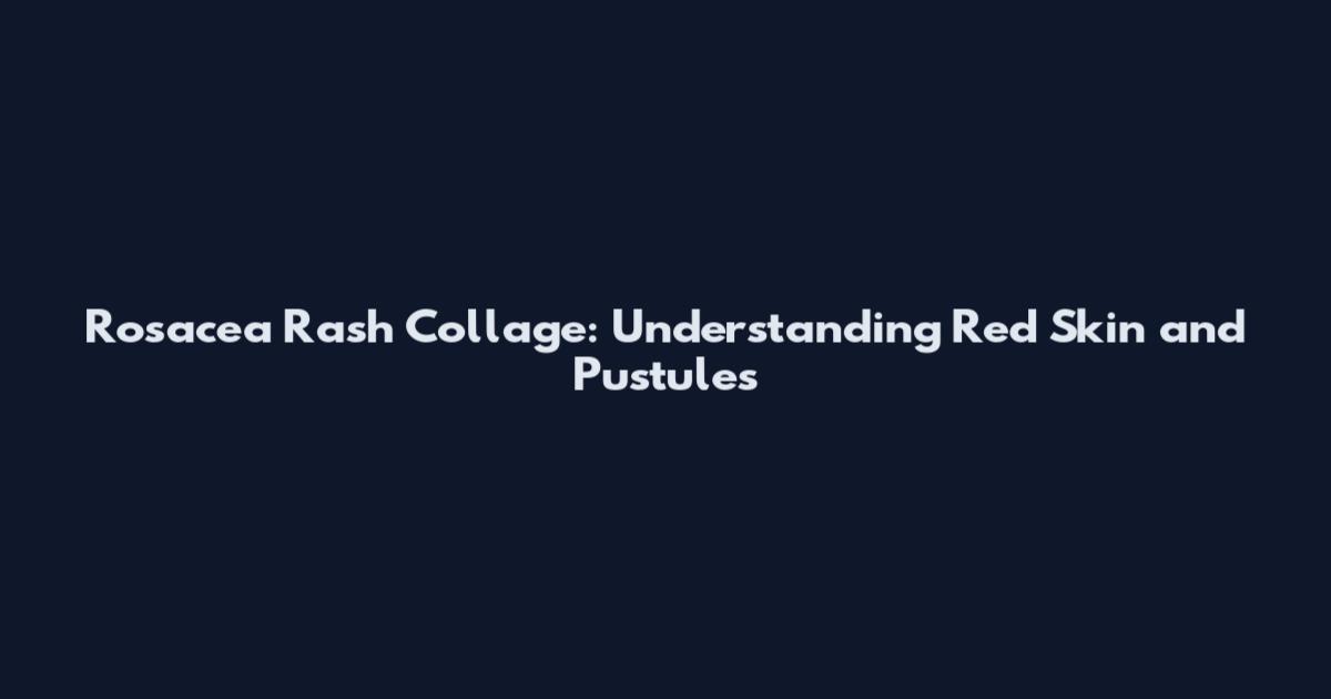 Rosacea Rash Collage: Understanding Red Skin and Pustules