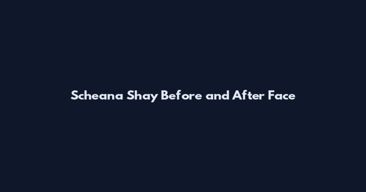Scheana Shay Before and After Face