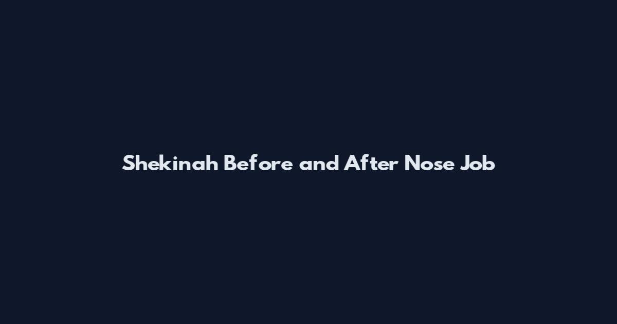 Shekinah Before and After Nose Job