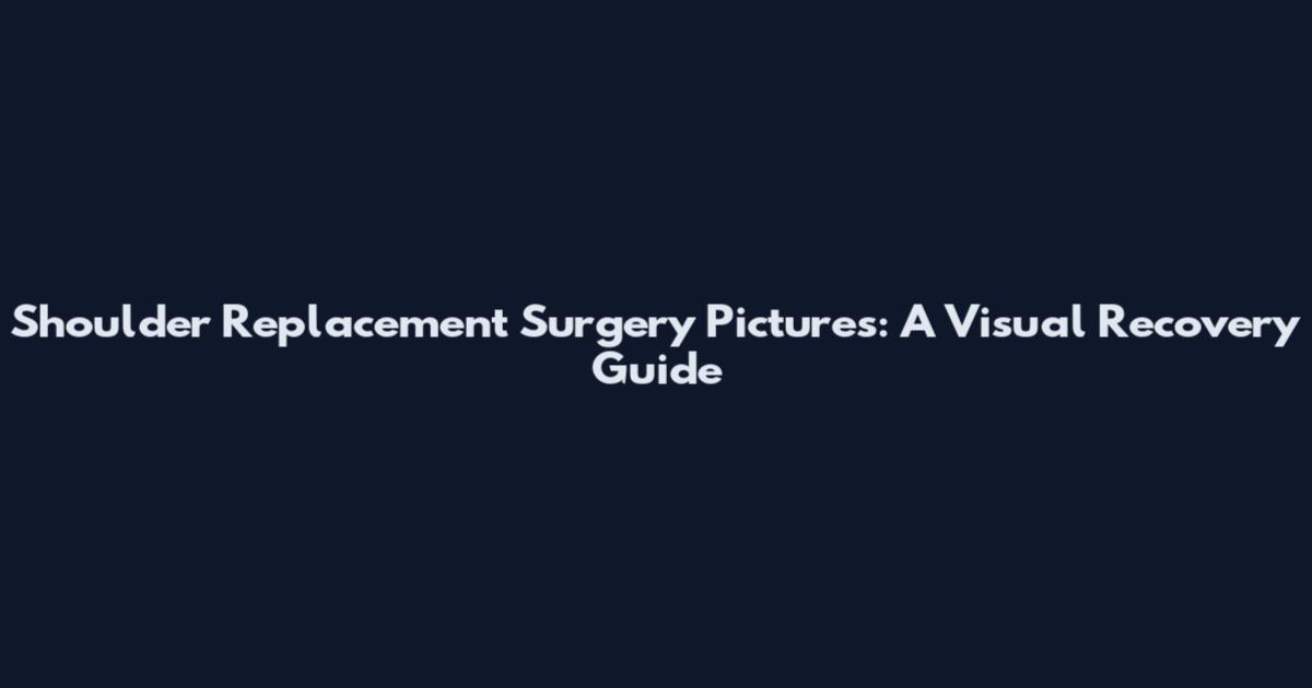 Shoulder Replacement Surgery Pictures: A Visual Recovery Guide