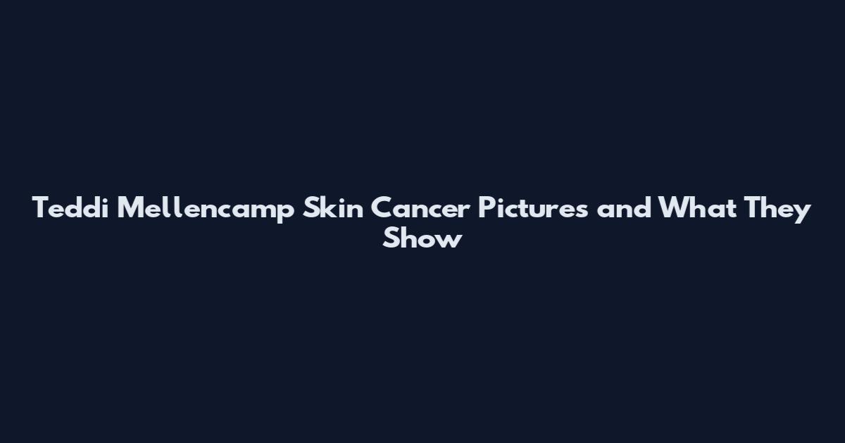 Teddi Mellencamp Skin Cancer Pictures and What They Show