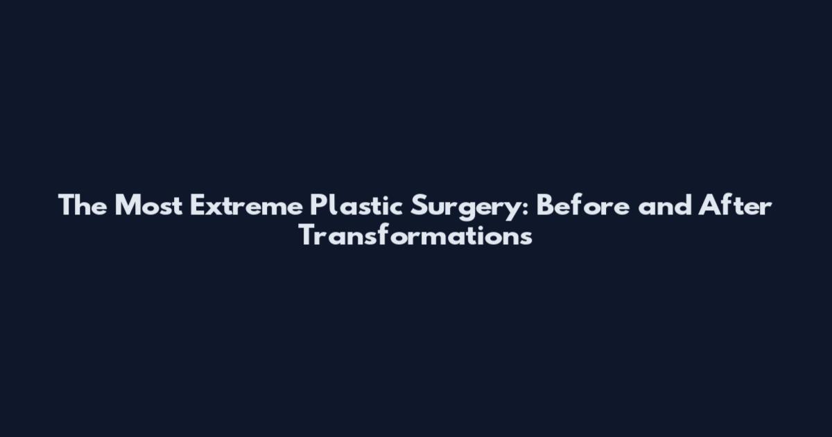The Most Extreme Plastic Surgery: Before and After Transformations