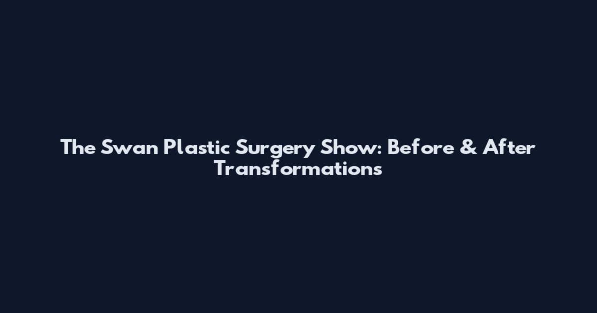 The Swan Plastic Surgery Show: Before & After Transformations