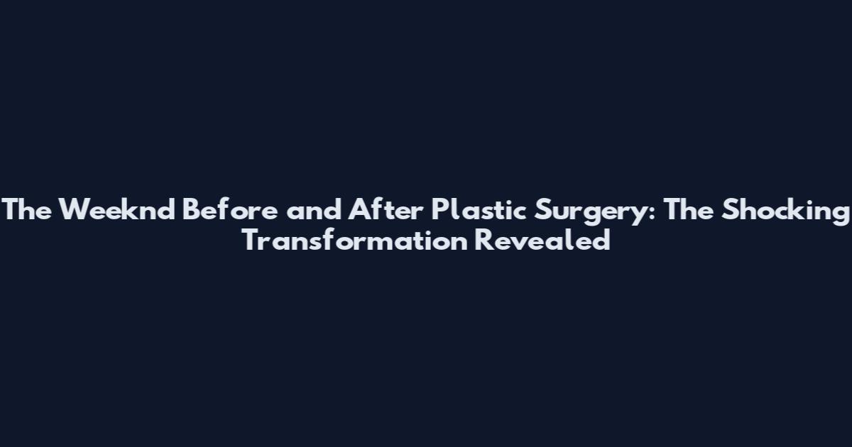 The Weeknd Before and After Plastic Surgery: The Shocking Transformation Revealed