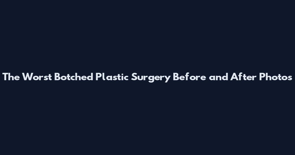 The Worst Botched Plastic Surgery Before and After Photos