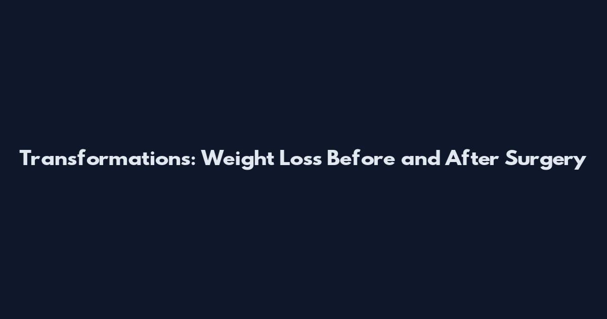 Transformations: Weight Loss Before and After Surgery