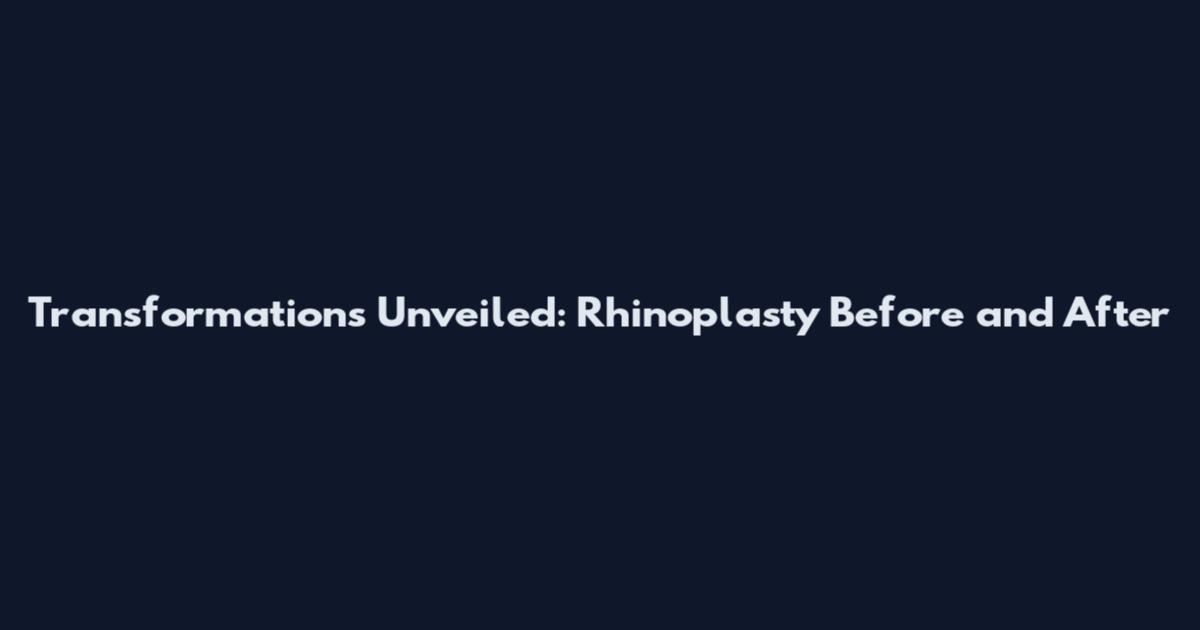 Transformations Unveiled: Rhinoplasty Before and After