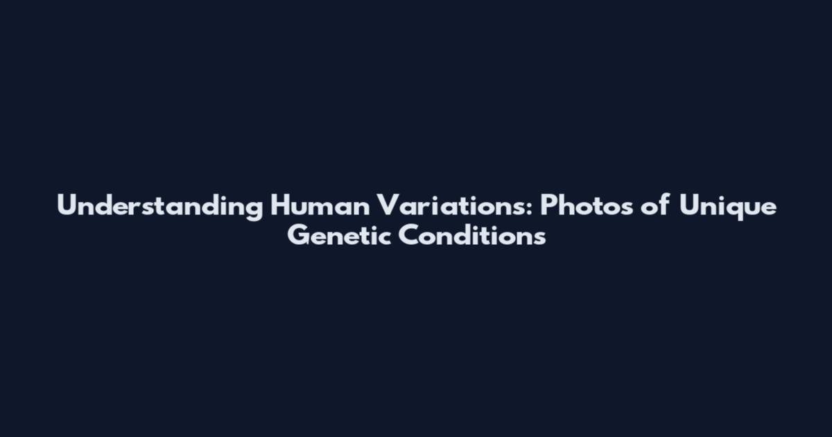 Understanding Human Variations: Photos of Unique Genetic Conditions