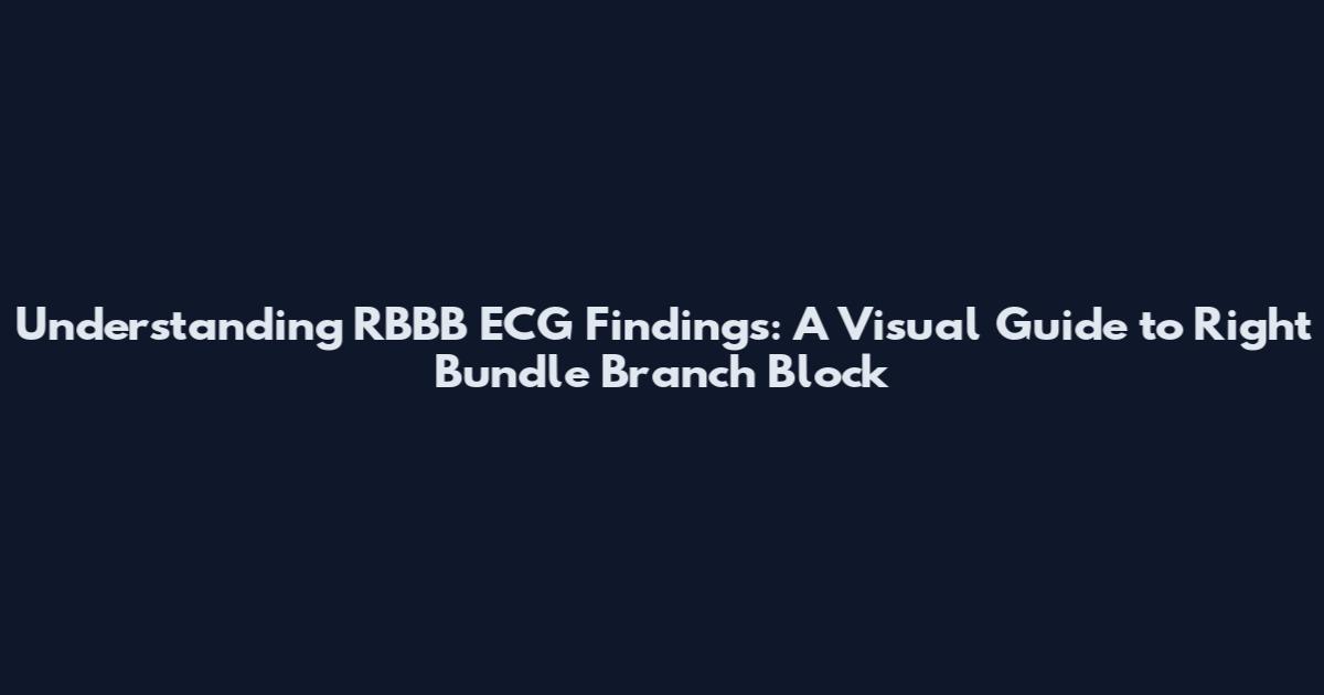 Understanding RBBB ECG Findings: A Visual Guide to Right Bundle Branch Block