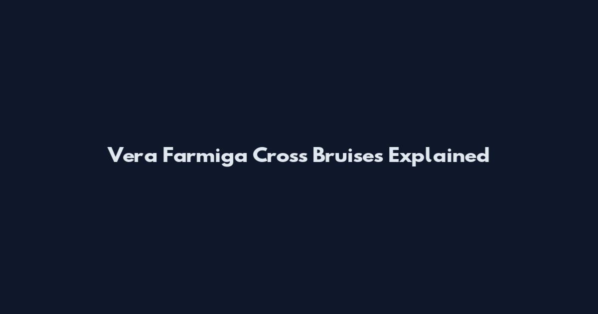 Vera Farmiga Cross Bruises Explained